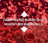 Clumping Blood Cells